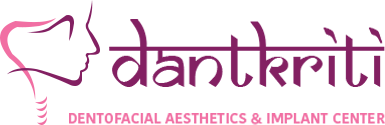 Dantkriti Dental Clinic Dental and Implant  Doctor in Gurgaon